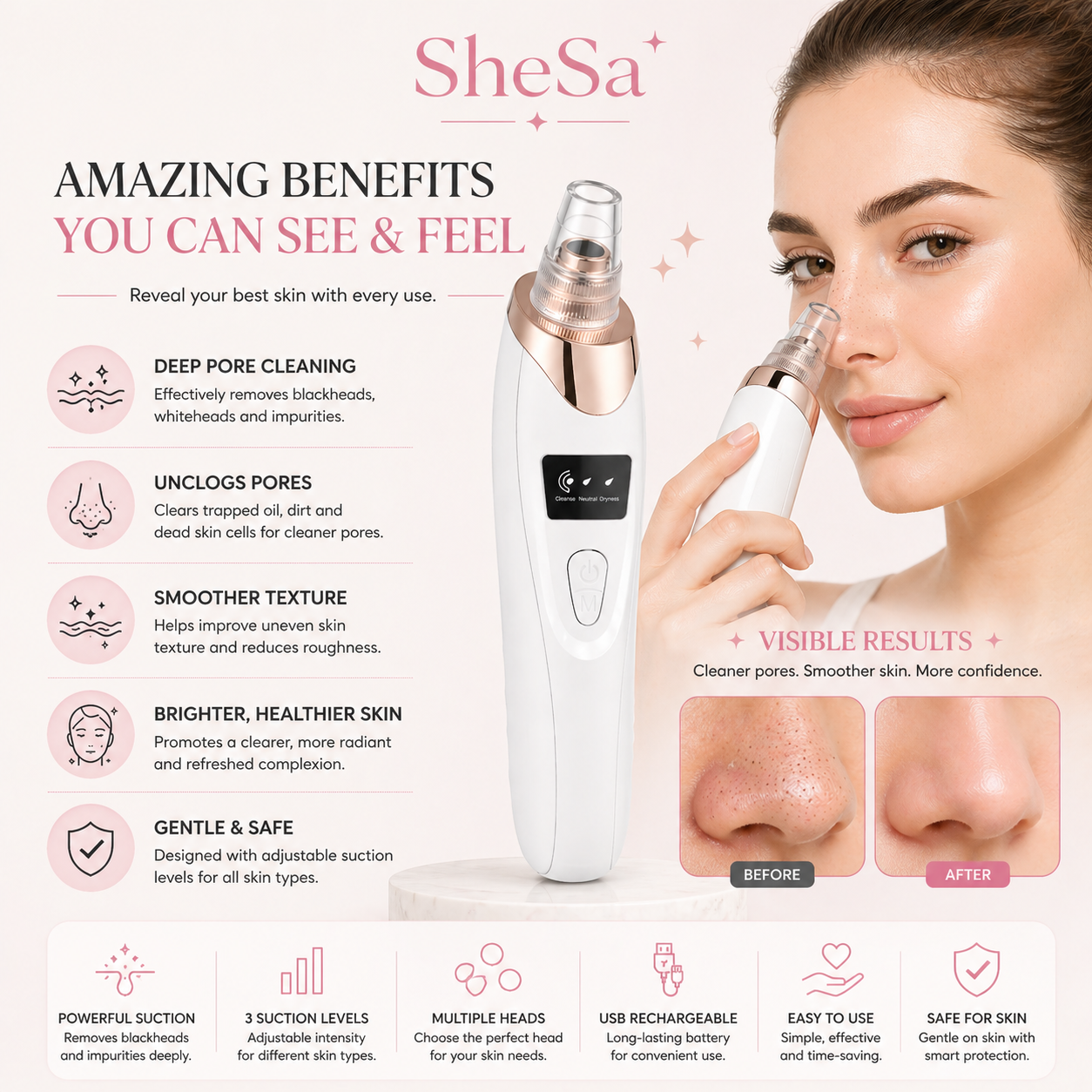 Pore Vacuum Blackhead Remover | SheSa™