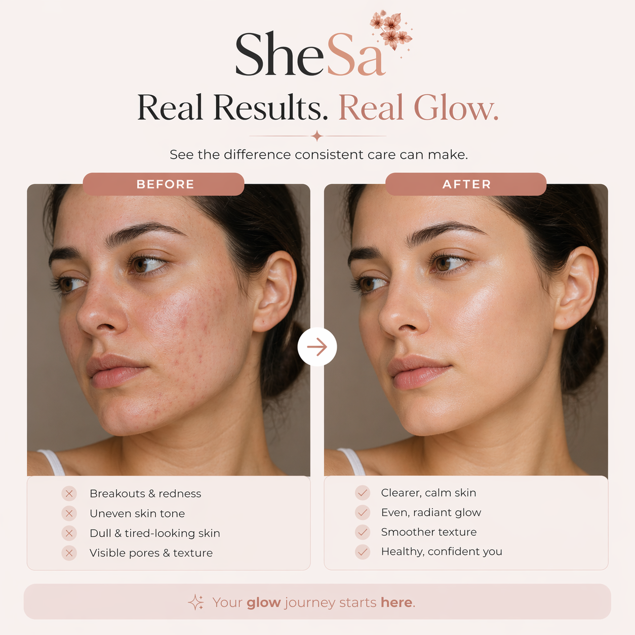 7-Color LED Facial Mask | SheSa™