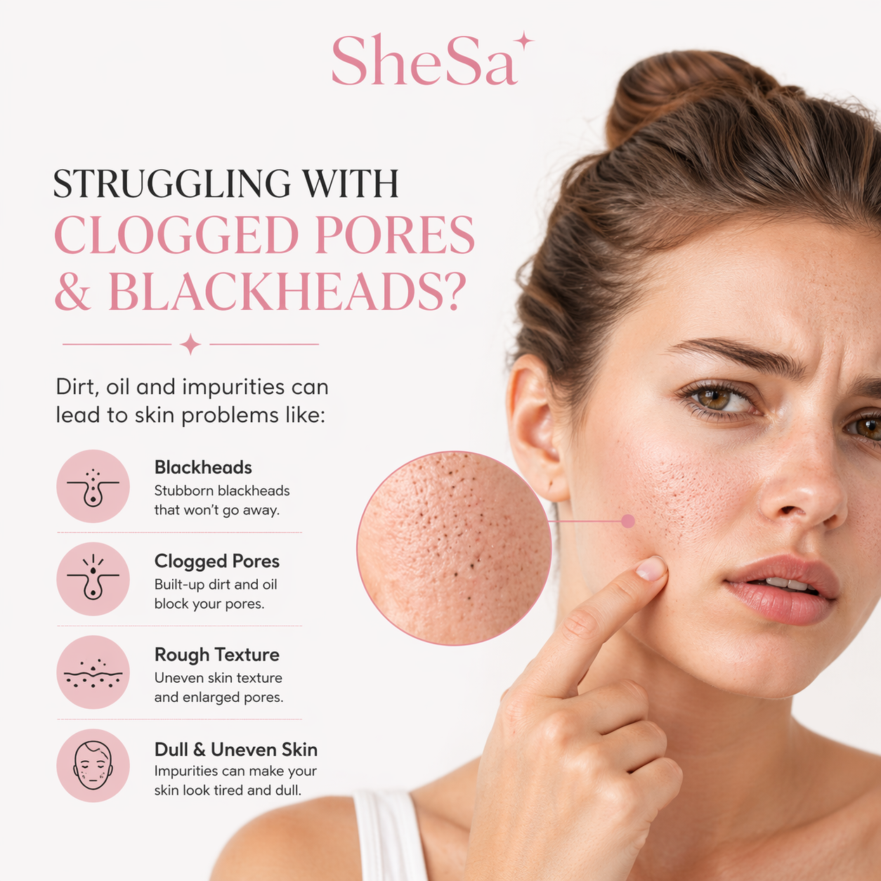 Pore Vacuum Blackhead Remover | SheSa™