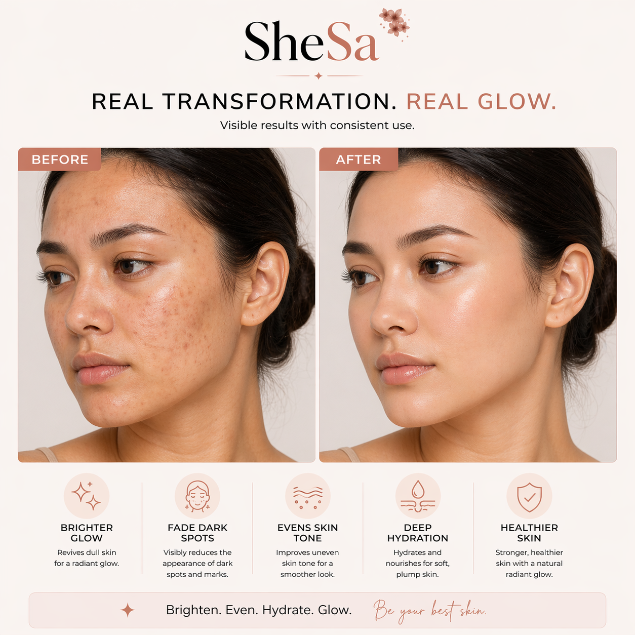 Vitamin C Glow Kit | SheSa™