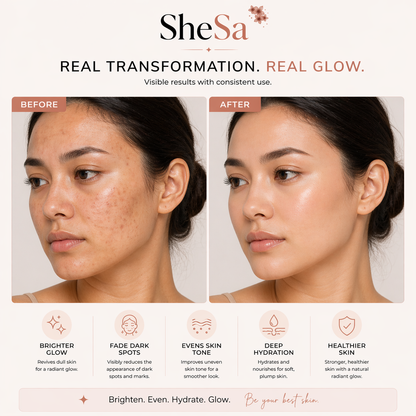 Vitamin C Glow Kit | SheSa™