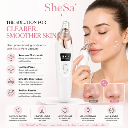 Pore Vacuum Blackhead Remover | SheSa™